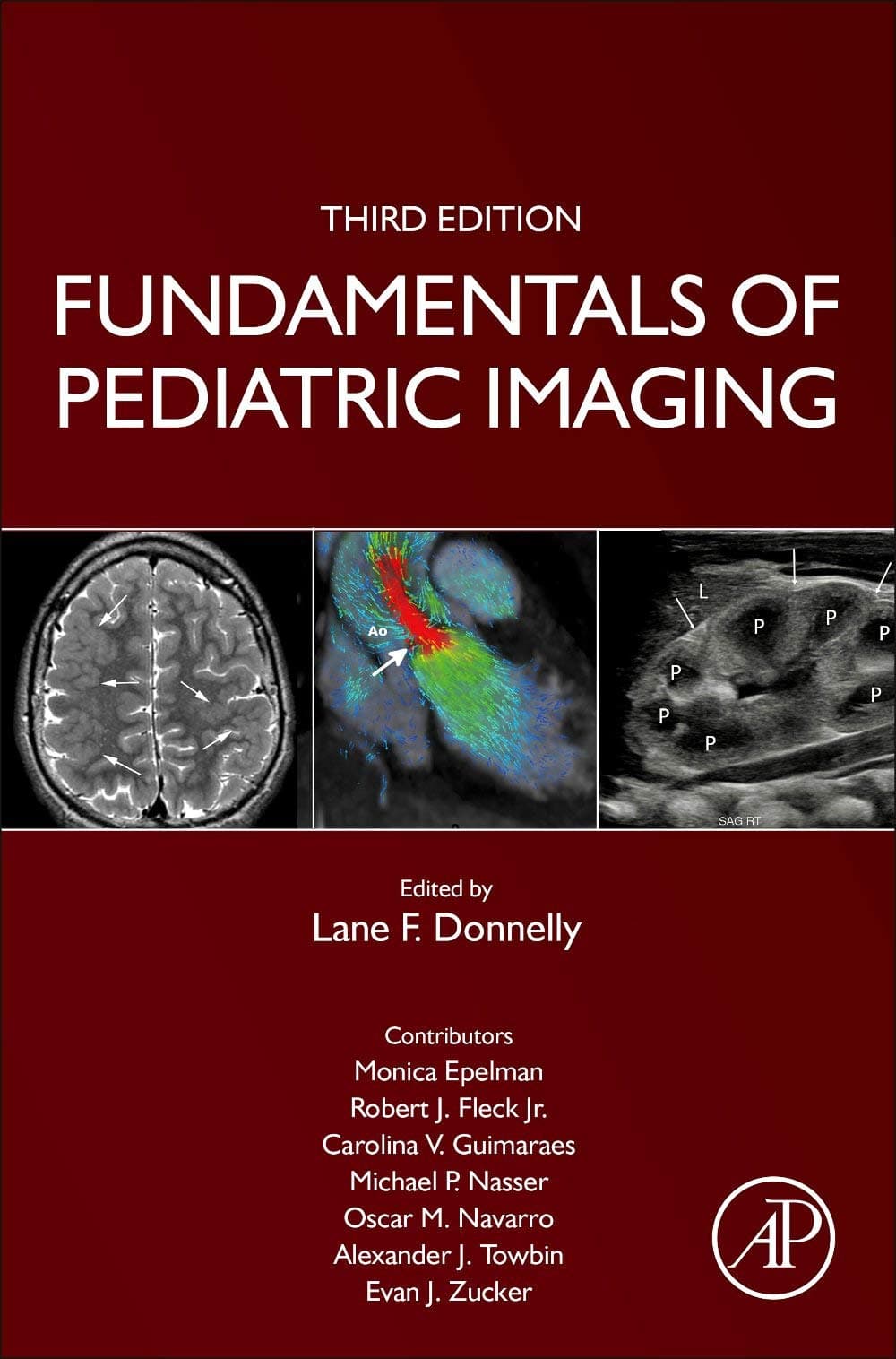Fundamentals of Pediatric Imaging 3rd/2022
