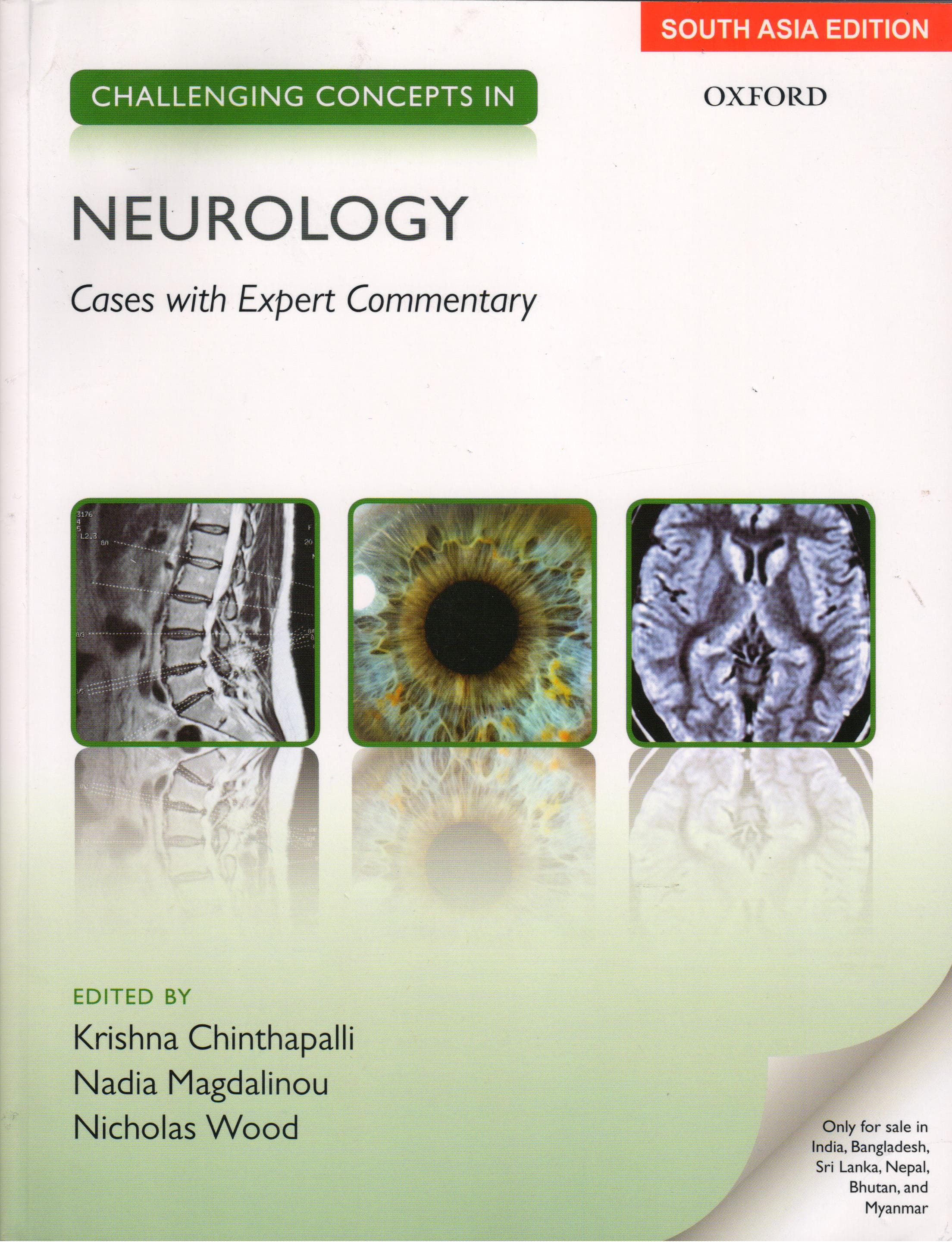 Challenging Concepts in Neurology 1st/2017 (Reprint)
