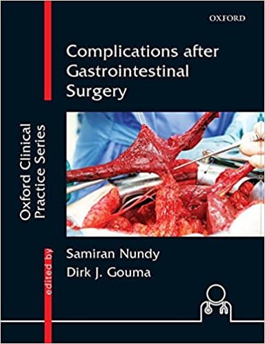 Complications After Gastrointestinal Surgery 1st/2017