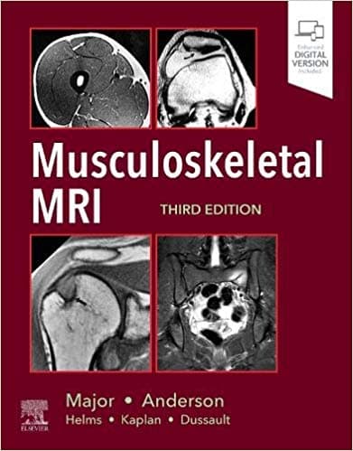 Musculoskeletal MRI 3rd/2020