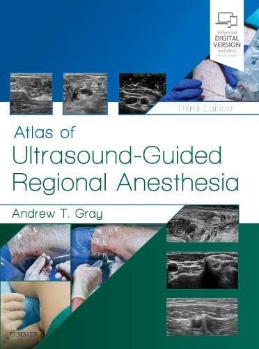 Atlas of Ultrasound Guided Regional Anesthesia 3rd/2018