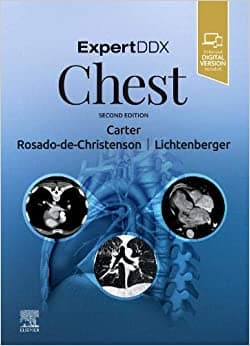Expert DDX Chest 2nd/2020
