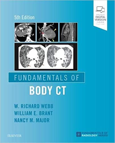 Fundamentals of Body CT 5th/2019