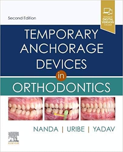 Temporary Anchorage Devices in Orthodontics 2nd/2021