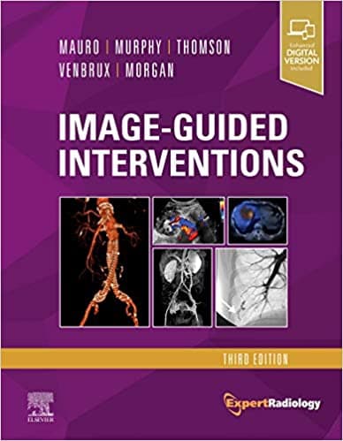 Image Guided Interventions 3rd/2020