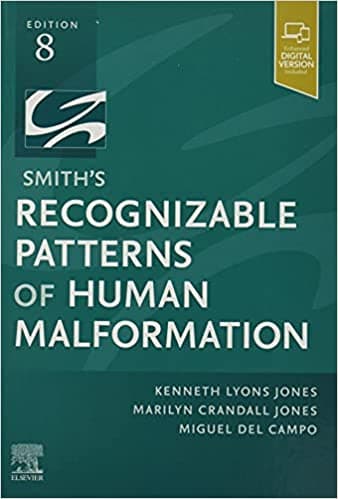 Smith's Recognizable Patterns of Human Malformation 8th/2021