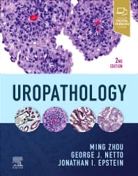 Uropathology 2nd/2023