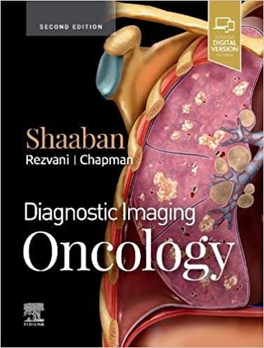 Diagnostic Imaging Oncology 2nd/2020