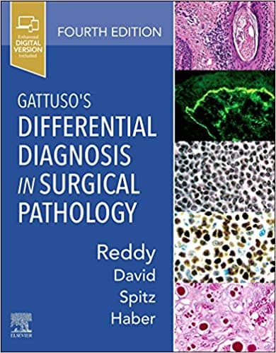Gattusos Differential Diagnosis in Surgical Pathology 4th/2021