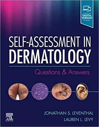 Self Assessment in Dermatology Questions and Answers 1st/2020