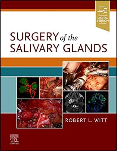 Surgery of the Salivary Glands 1st/2021