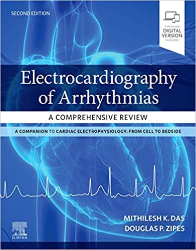 Electrocardiography of Arrhythmias A Comprehensive Review 2nd/2021