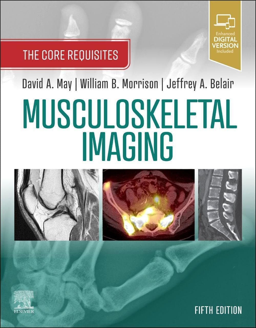 Musculoskeletal Imaging The Core Requisites 5th/2022