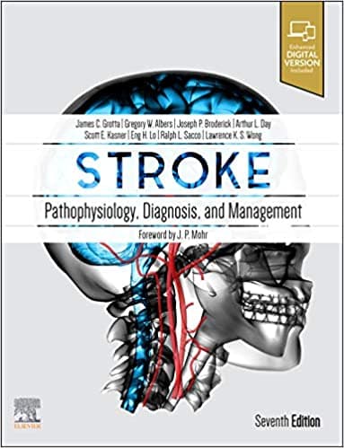 Stroke Pathophysiology, Diagnosis, and Management 7th/2021
