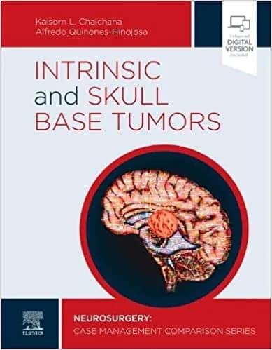 Intrinsic and Skull Base Tumors 1st/2021