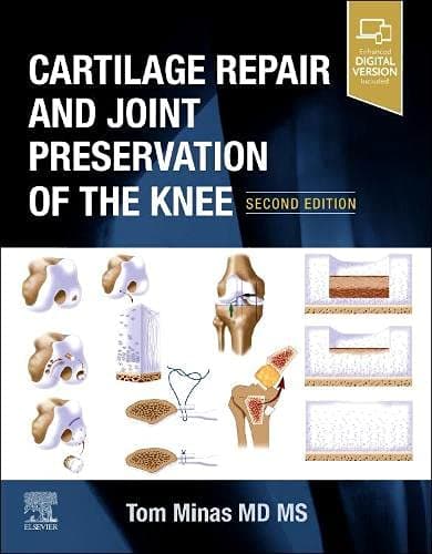 Cartilage Repair and Joint Preservation of the Knee 2nd/2022