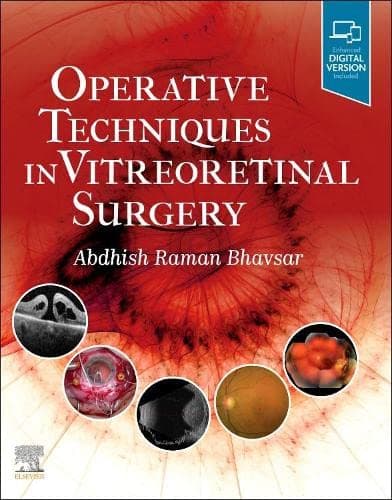 Operative Techniques in Vitreoretinal Surgery 1st/2023