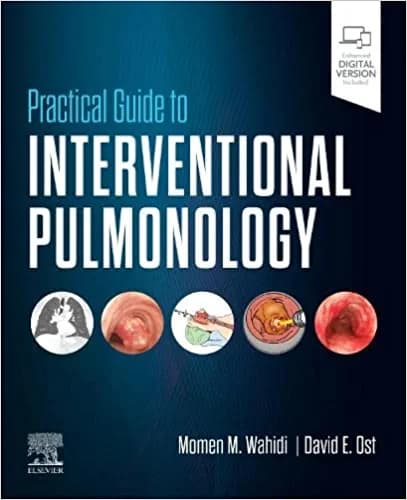 Practical Guide to Interventional Pulmonology 1st/2023