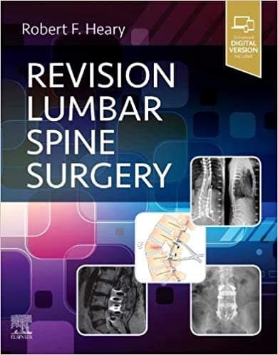 Revision Lumbar Spine Surgery 1st/2021