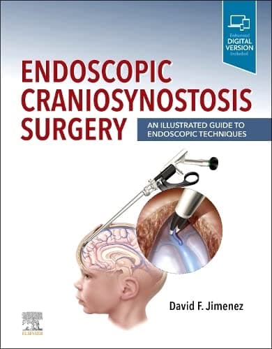 Endoscopic Craniosynostosis Surgery 1st/2022