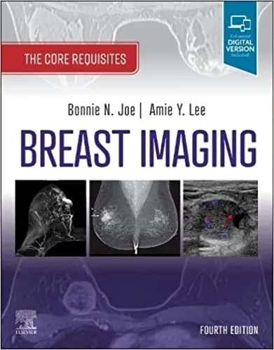 Breast Imaging the Core Requisites 4th/2023