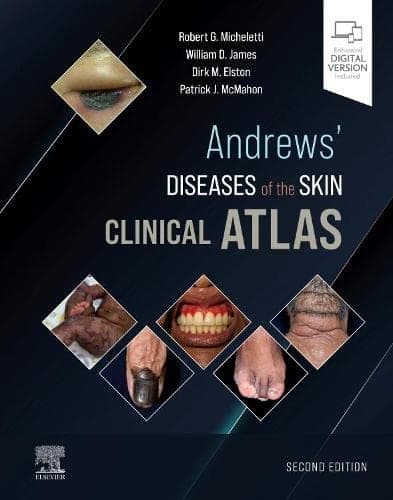 Andrews Diseases of the Skin Clinical Atlas 2nd/2022