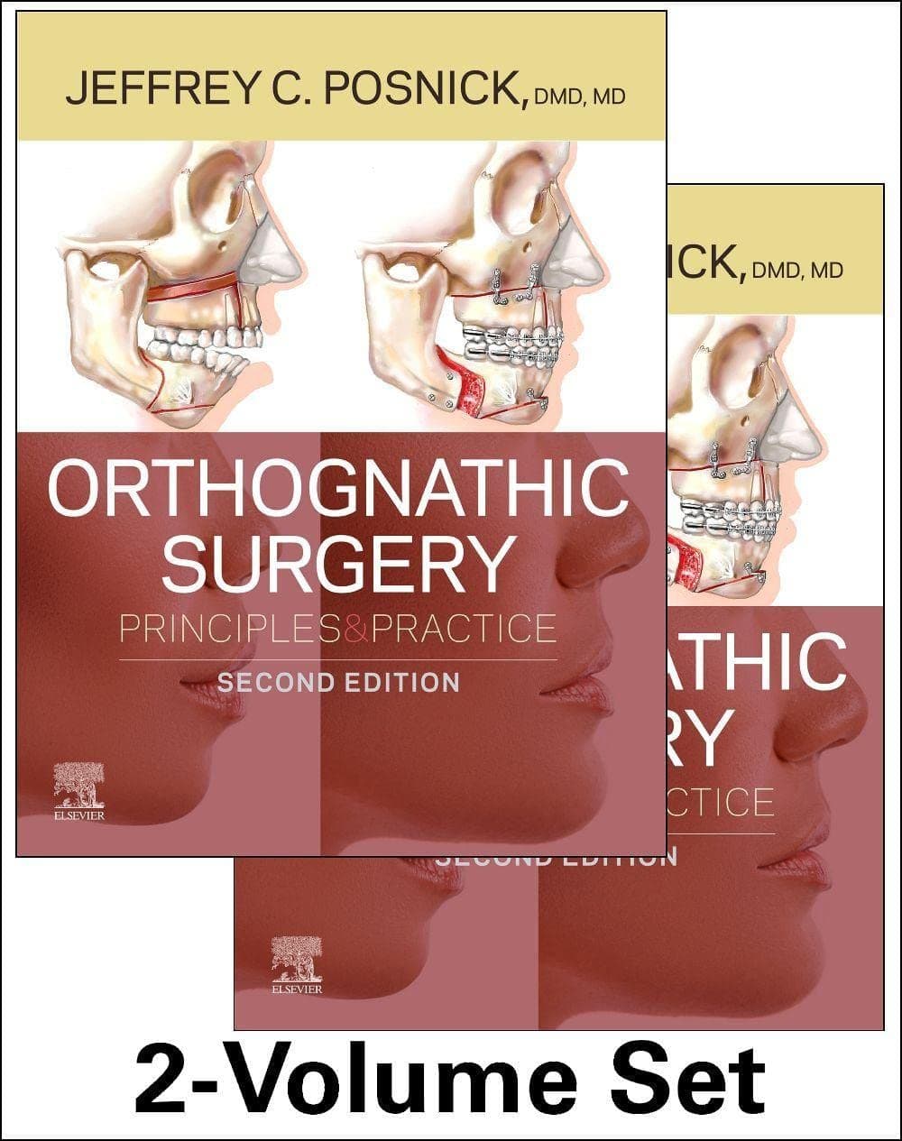 Orthognathic Surgery 2nd/2022 (2 Vols)