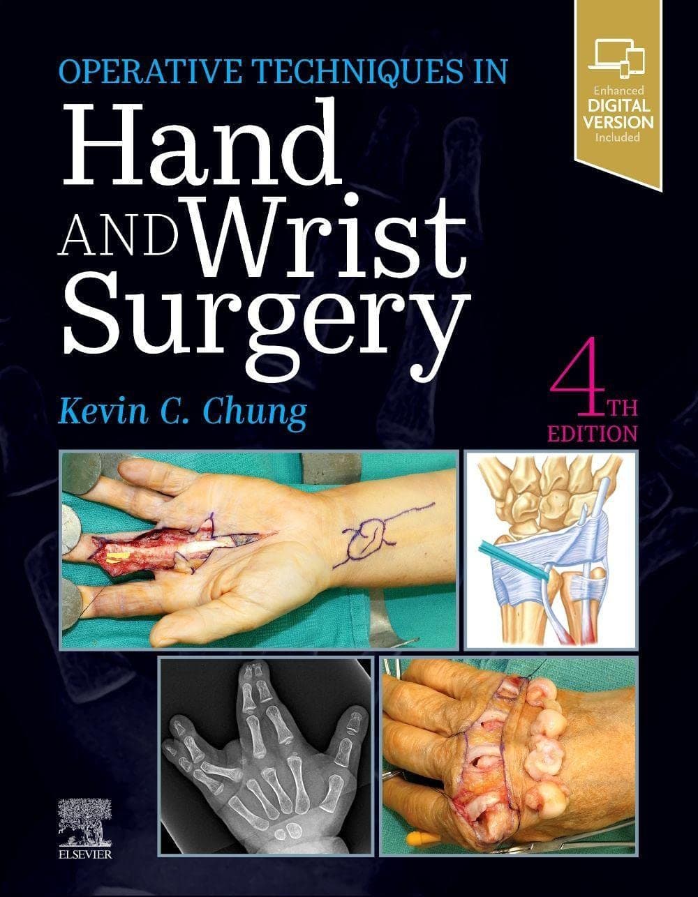 Operative Techniques Hand and Wrist Surgery 4th/2022