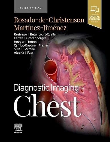 Diagnostic Imaging Chest 3rd/2022