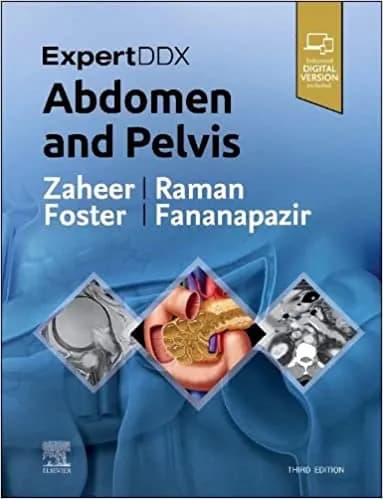 Expert DDX Abdomen and Pelvis 3rd/2023