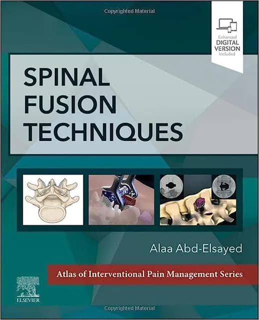 Spinal Fusion Techniques 1st/2024