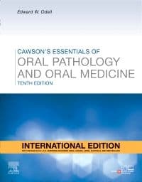 Cawson's Essentials of Oral Pathology and Oral Medicine 10th IE/2024