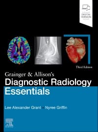 Grainger and Allison's Diagnostic Radiology Essentials  3rd/2024