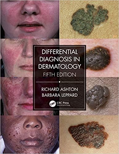 Differential Diagnosis in Dermatology 5th/2021