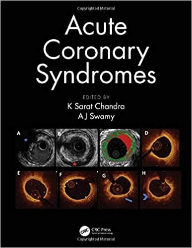 Acute Coronary Syndromes 1st/2021