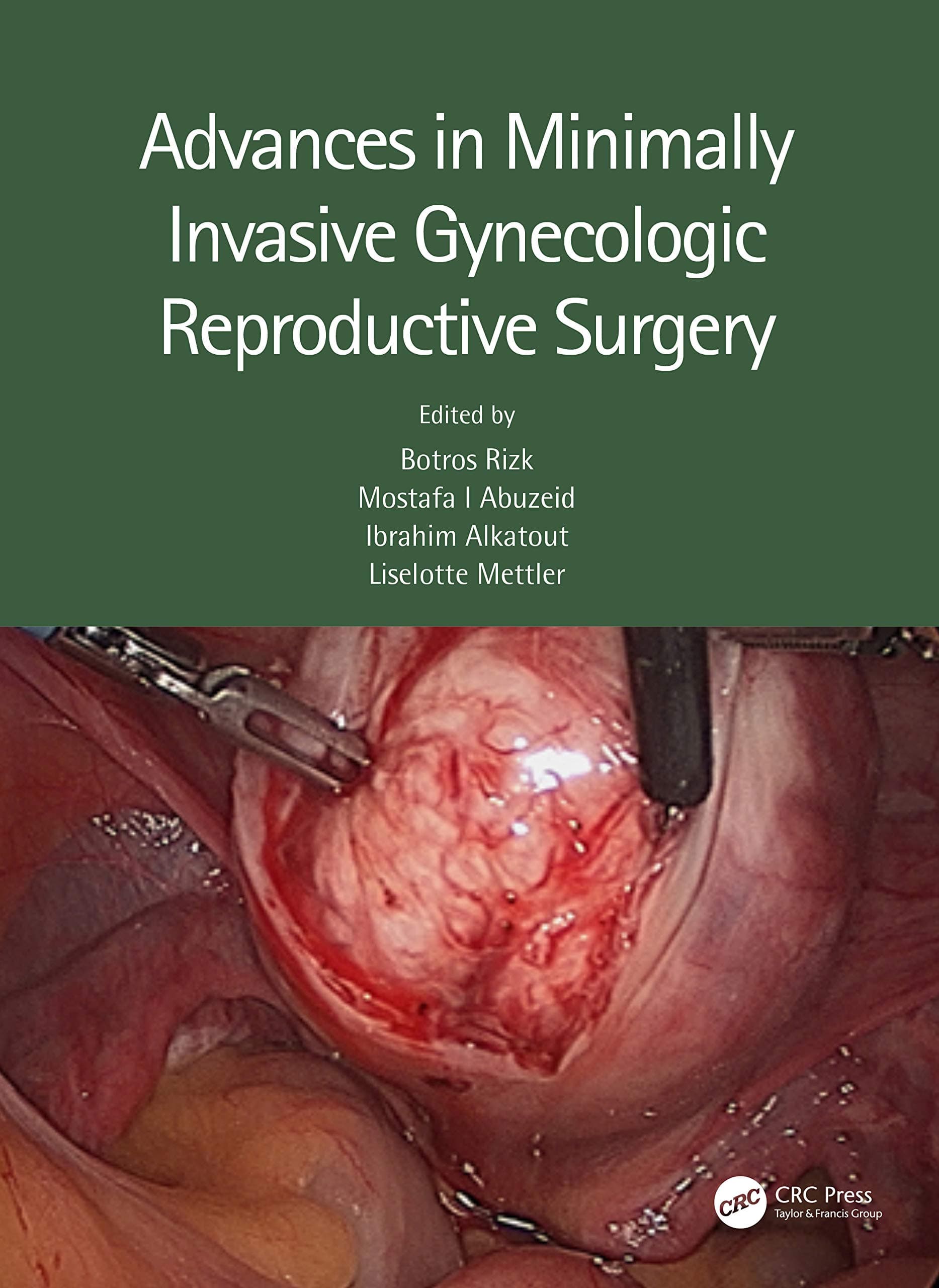 Advances in Minimally Invasive Gynecologic Reproductive Surgery 1st/2022