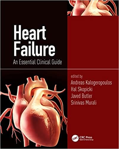 Heart Failure An Essential Clinical Guide 1st/2023