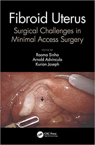 Fibroid Uterus 1st/2021