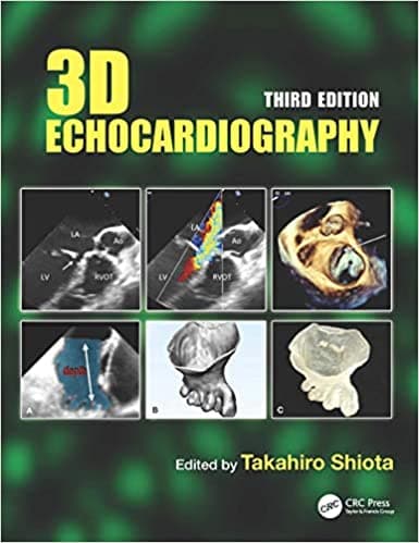 3D Echocardiography 3rd/2021