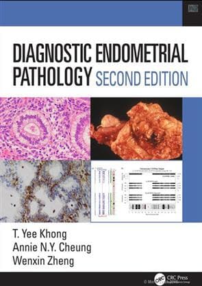 Diagnostic Endometrial Pathology 2nd/2020