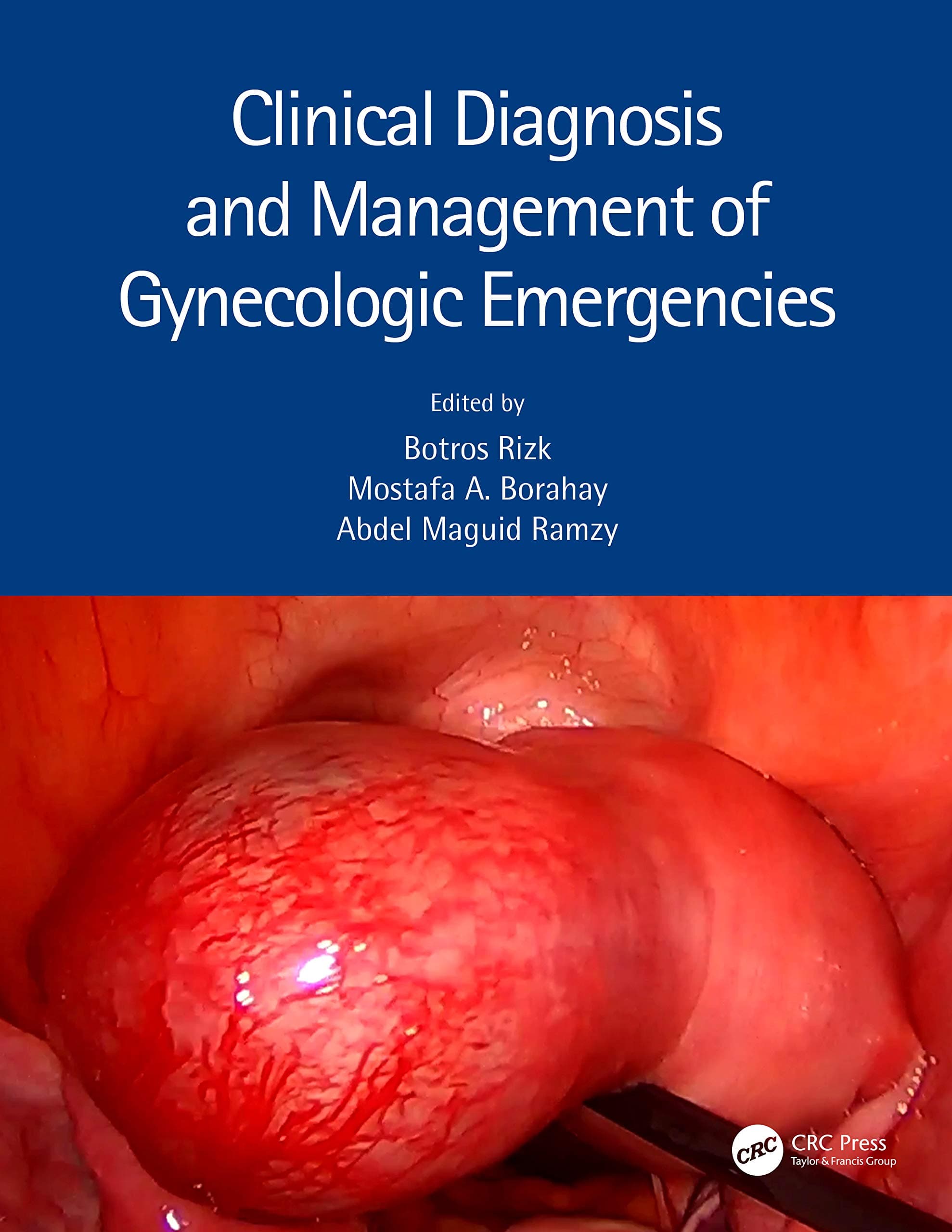Clinical Diagnosis and Management of Gynecologic Emergencies 1st/2021