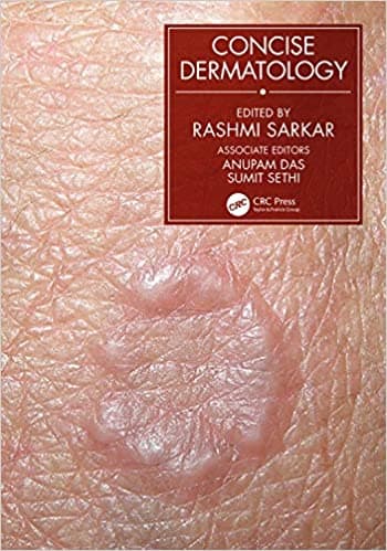 Concise Dermatology 1st/2021