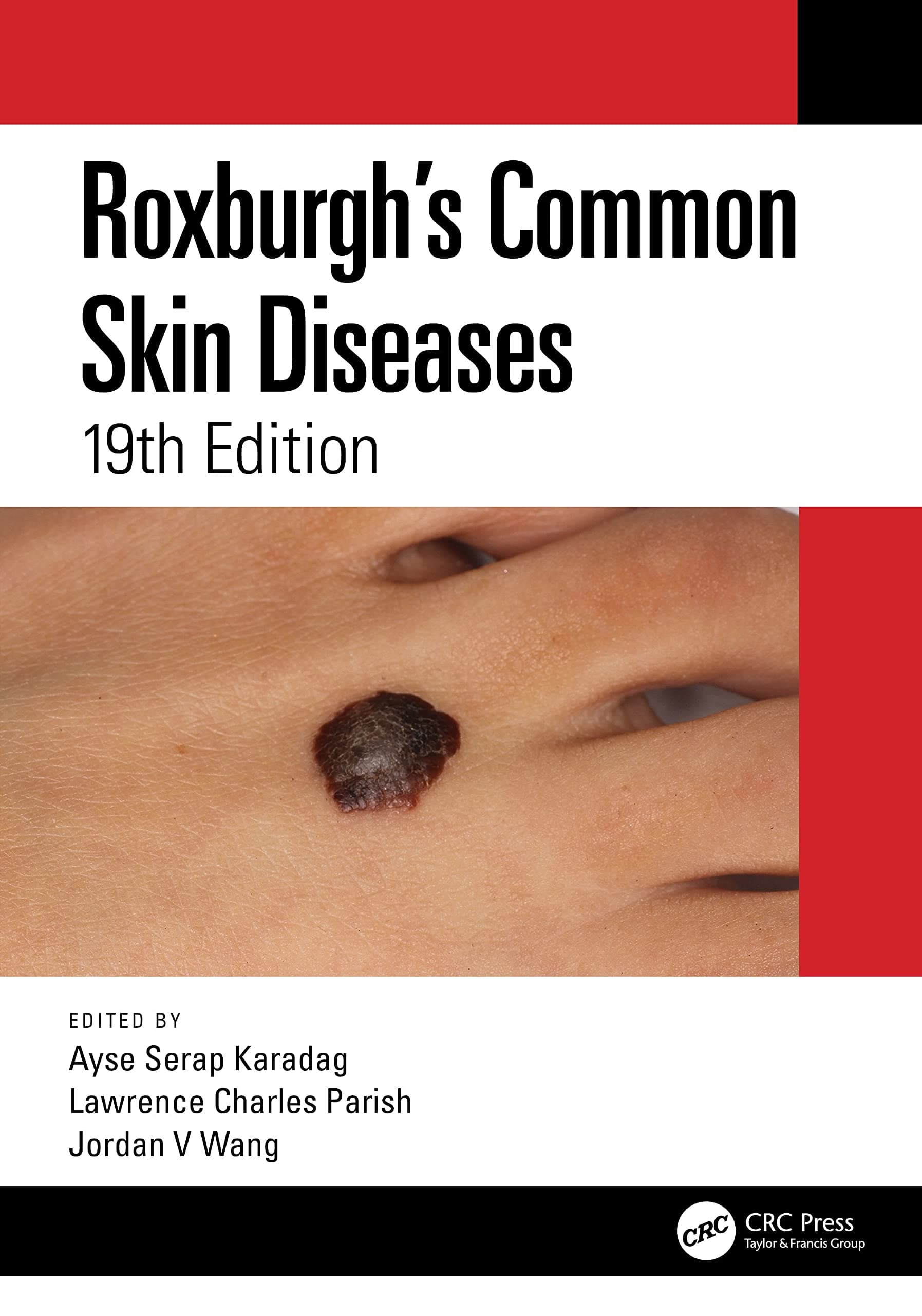 Roxburghs Common Skin Diseases 19th/2022