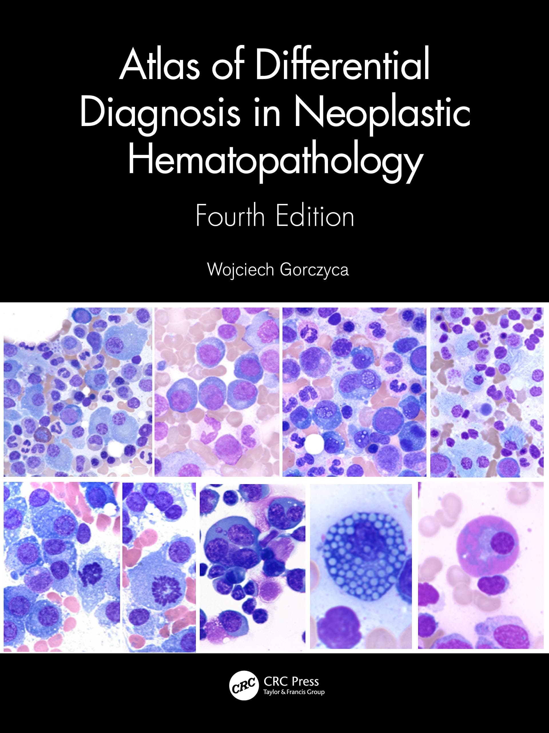 Atlas of Differential Diagnosis in Neoplastic Hematopathology 4th/2022