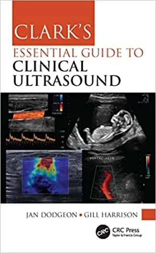 Clark's Essential Guide to Clinical Ultrasound 1st/2023