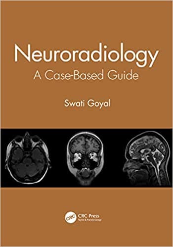 Neuroradiology A Case Based Guide 1st/2021