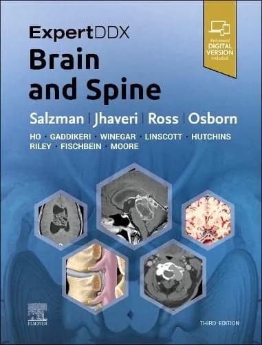 ExpertDDX Brain and Spine 3rd/2024