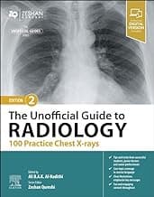 The Unofficial Guide to Radiology 100 Practice Chest X Rays 2nd/2024