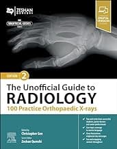 The Unofficial Guide to Radiology 100 Practice Orthopaedic X Rays 2nd/2024