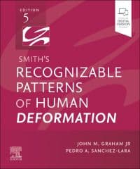 Smith's Recognizable Patterns of Human Deformation 5th/2024